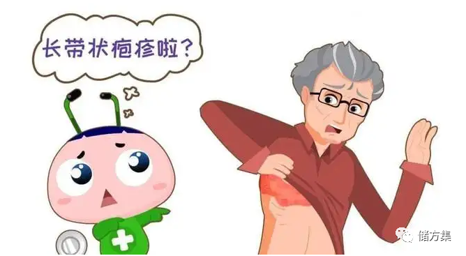 关于带状疱疹的小知识